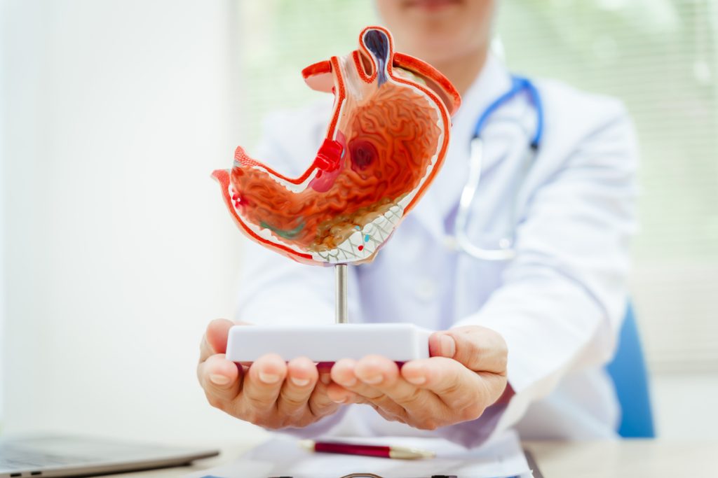 Médico gastroenterologia ao fundo segurando um protótipo de estômago que está em destaque na frente da imagem.